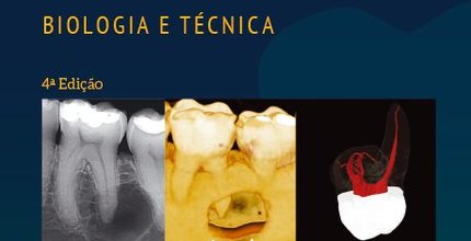  Biologia e técnica em Endodontia