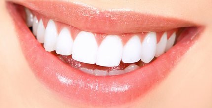 Conheça os tipos de implante dentários!